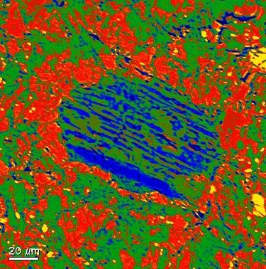 Granophyric intergrowth clast (blue and green).